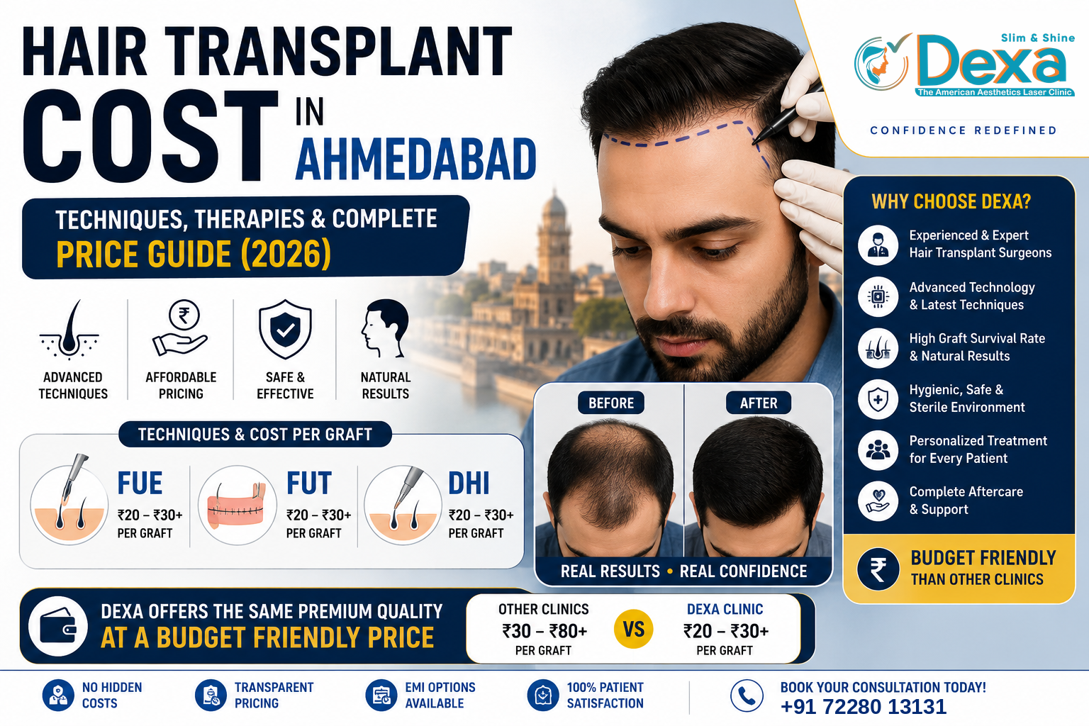 This infographic provides a complete overview of Hair Transplant Cost in Ahmedabad (2026), covering the three most popular hair transplant techniques—FUE, FUT, and DHI—along with their estimated per-graft pricing. The image highlights Dexa Clinic's key advantages, including experienced hair transplant surgeons, advanced technology, natural-looking results, hygienic facilities, personalized treatment plans, and post-treatment support. It also features